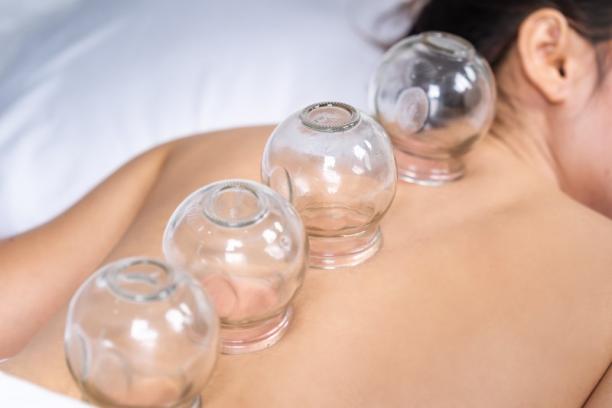 cupping therapy Anderlecht